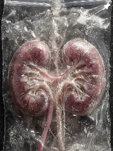 Kidneys reel cover